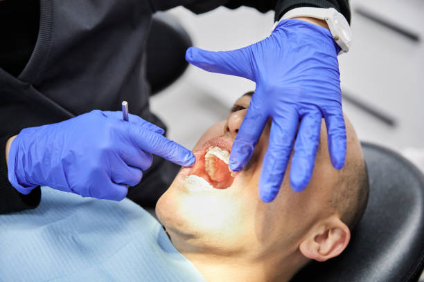 Best Broken or Chipped Tooth Repair in Pike Creek Valley, DE